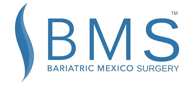 Bariatric Surgery Mexico