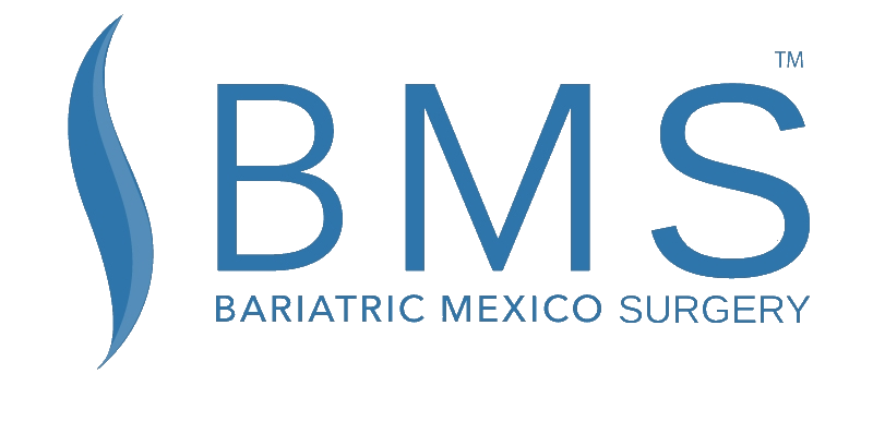 Bariatric Mexico Surgery